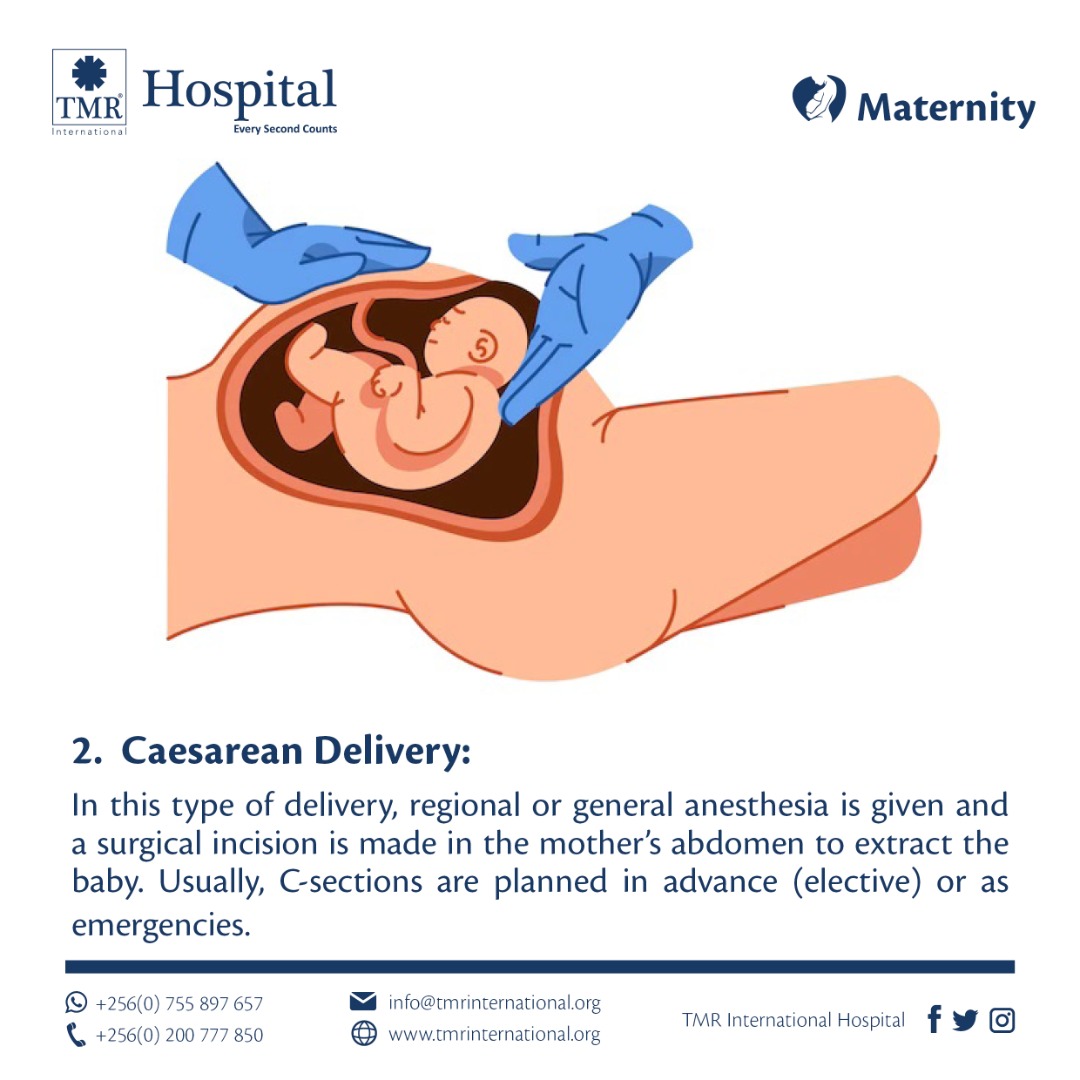 Child birth caesarean delivery