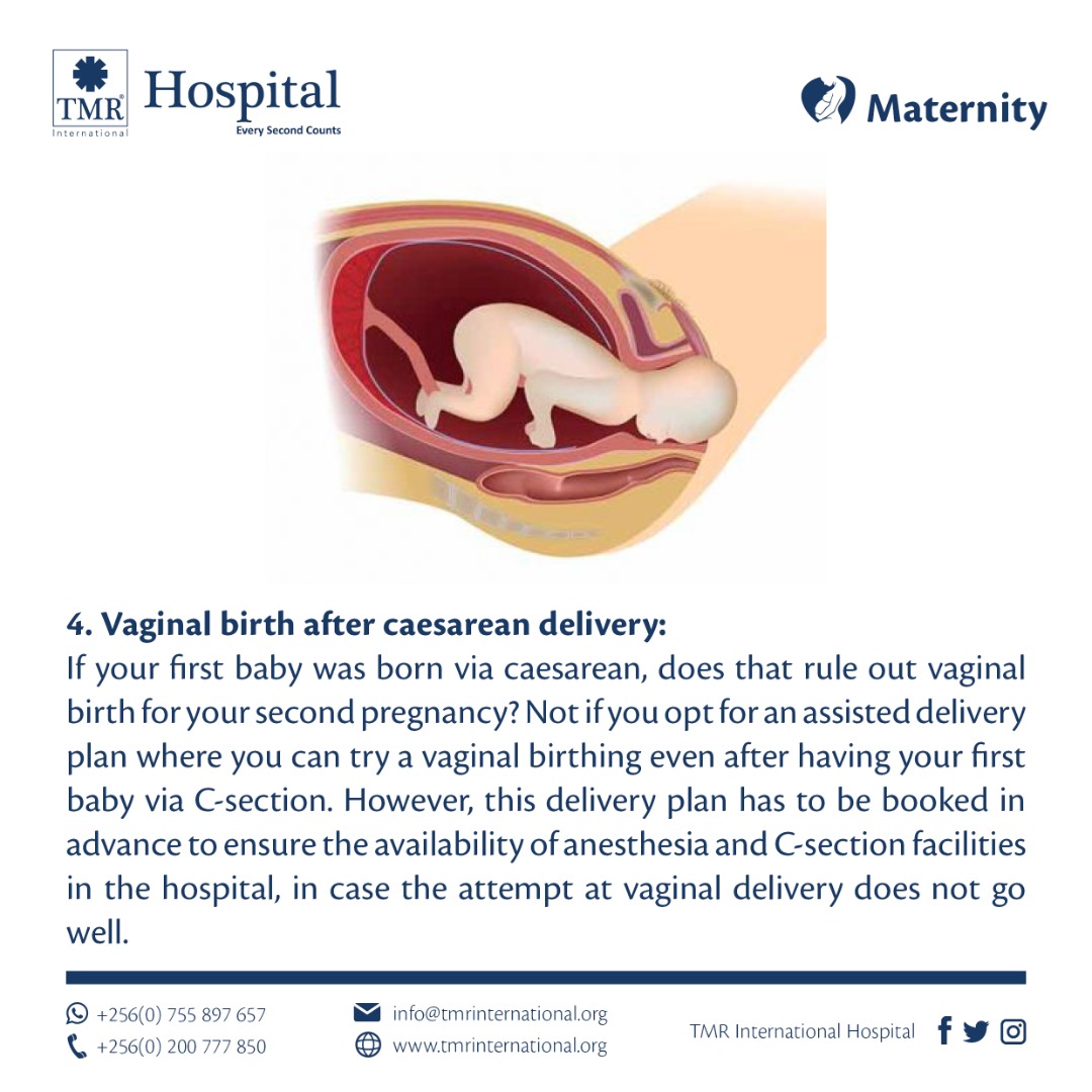 Child birth Vaginal birth after caesarean delivery